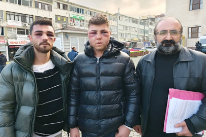 Bursa'da kendilerine şiddet uygulayan polisleri teşhis ettiler: Dava açılmadı