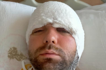 Bursa'da diş tedavisinde beynine implant saplanan adam 2 yıldır adalet bekliyor