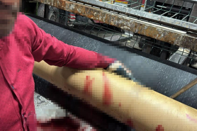 Bursa'da silindir makinasına elini kaptıran işçi ağır yaralandı