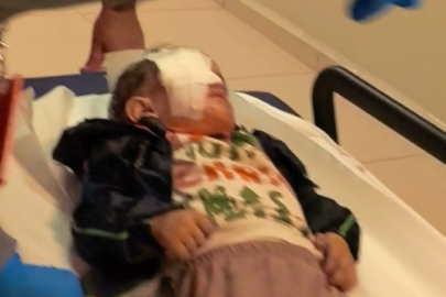 Bursa'da torpil faciasında 2 yaşındaki çocuk ağır yaralandı