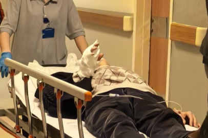 Bursa'da iş kazası: 66 yaşındaki adam parmağını kaybetti